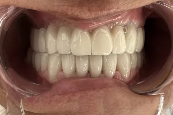 Öz Ay Dent Ağız ve Diş Sağlığı Polikliniği - Resim 19