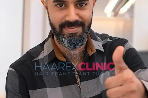 HAAREX CLİNİC SAÇ EKİM - HAİRTRANSPANT ANTALYA - Resim 8