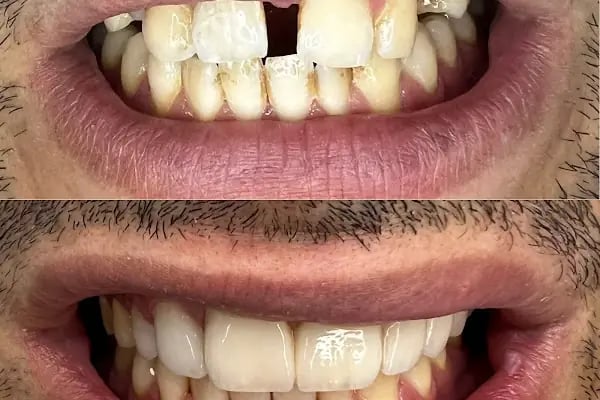 Alanya PetraDent Ağız ve Diş Sağlığı Polikliniği - Resim 2