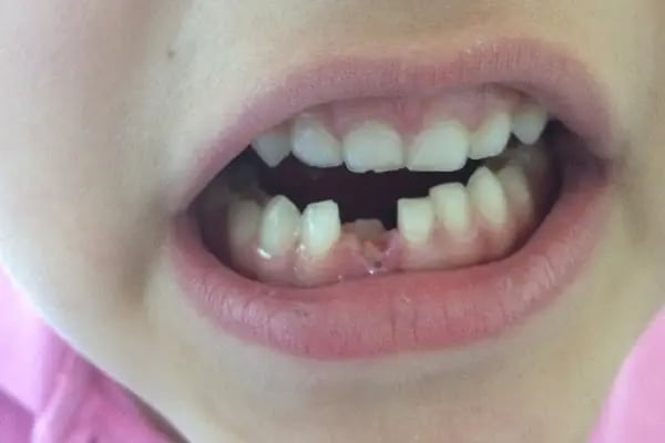 Bornova 17 Nolu Aile Sağlık Merkezi - Resim 2
