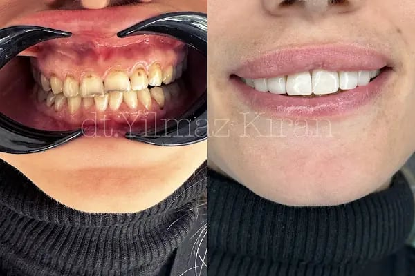 DİŞ HEKİMİ YILMAZ KIRAN - Resim 2