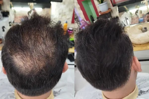 İlke hair studıo BARBER SHOP - Resim 13