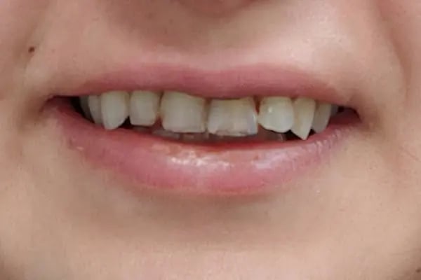 Elitia Dental Studio Turkey - Resim 4