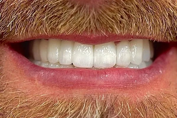 Touch Dent Ağız ve Diş Sağlığı - Resim 7
