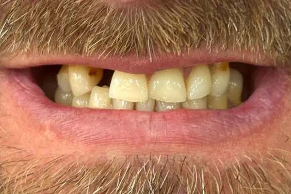Touch Dent Ağız ve Diş Sağlığı - Resim 15