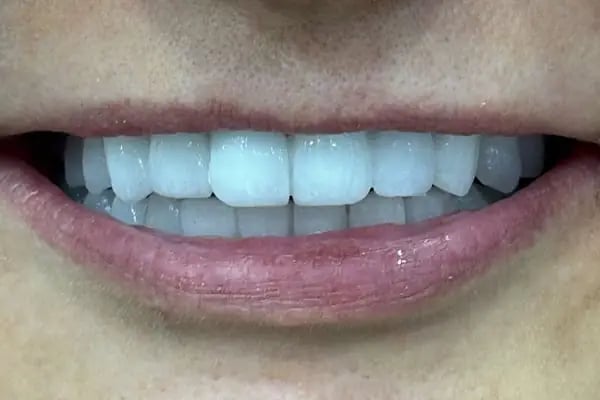 Touch Dent Ağız ve Diş Sağlığı - Resim 6