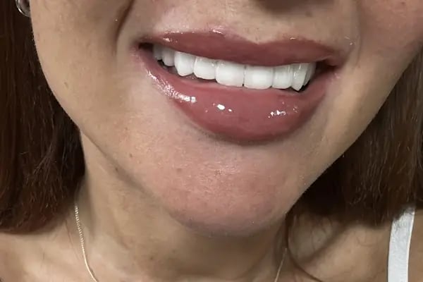 Touch Dent Ağız ve Diş Sağlığı - Resim 10