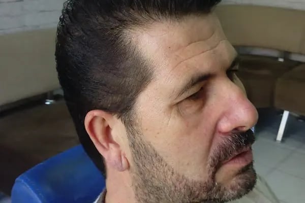 Beşyıldız Erkek Kuaförü - Resim 11