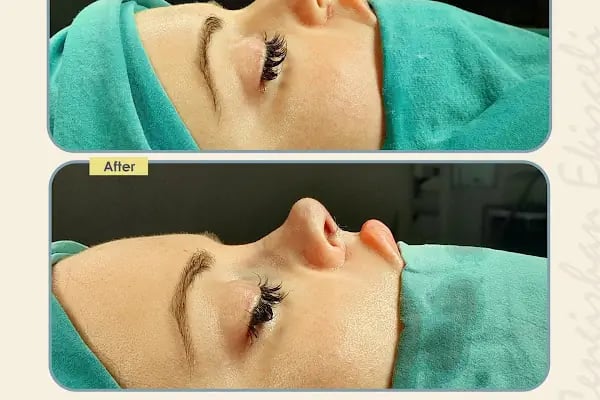 Dr. Cengizhan Ekizceli - Resim 15