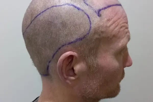 Academic Esthetic Sağlık Hizmetleri - Resim 4