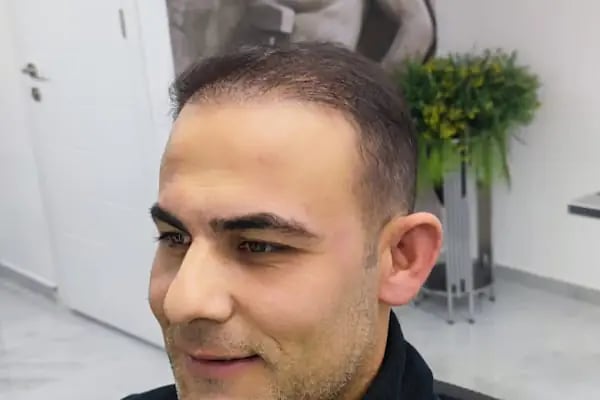 Ramazan Mehmet aktacı hair design - Resim 7