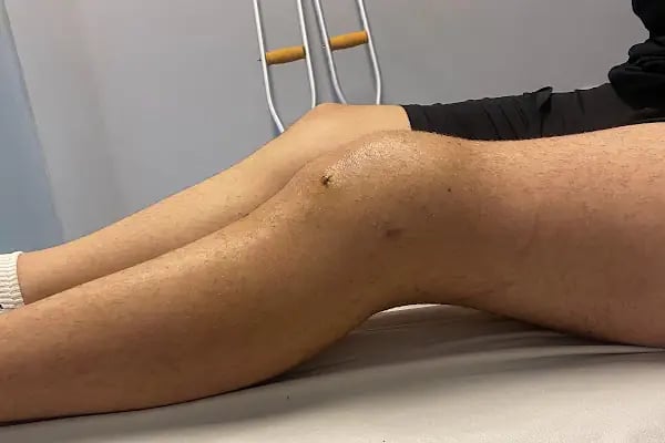 ORTHOPOİNT Ortopedi ve Fizik Tedavi Kliniği - Resim 11