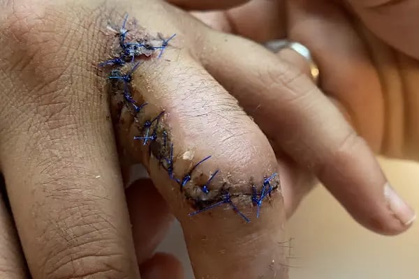 ORTHOPOİNT Ortopedi ve Fizik Tedavi Kliniği - Resim 10