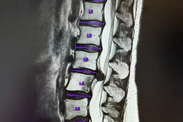 ORTHOPOİNT Ortopedi ve Fizik Tedavi Kliniği - Resim 15
