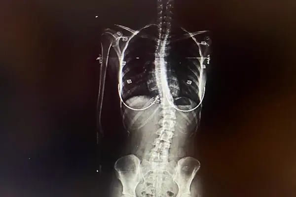 ORTHOPOİNT Ortopedi ve Fizik Tedavi Kliniği - Resim 3