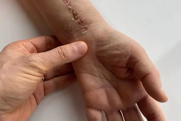 ORTHOPOİNT Ortopedi ve Fizik Tedavi Kliniği - Resim 8