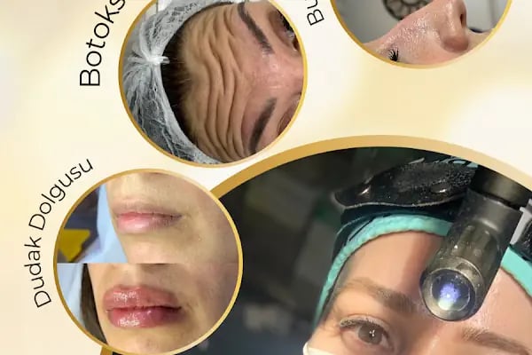 Op.Dr.Furkan Şengöz Yüz ve Burun Estetiği - Resim 12