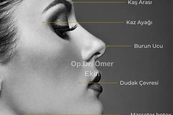 Op. Dr. Ömer Ekin | Plastik, Estetik Cerrahi Ankara | Burun Estetiği | Meme Estetiği | Karın Germe | Liposuction | Botoks - Resim 18