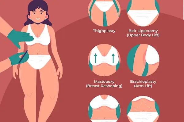 Op. Dr. Ömer Ekin | Plastik, Estetik Cerrahi Ankara | Burun Estetiği | Meme Estetiği | Karın Germe | Liposuction | Botoks - Resim 17