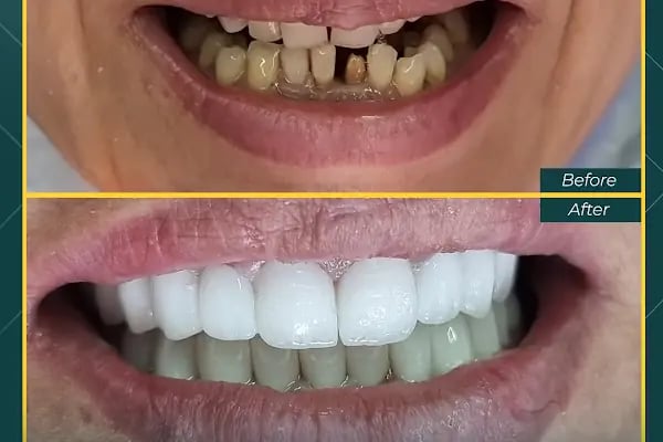 Oskar Smile Poliklinik - Resim 19