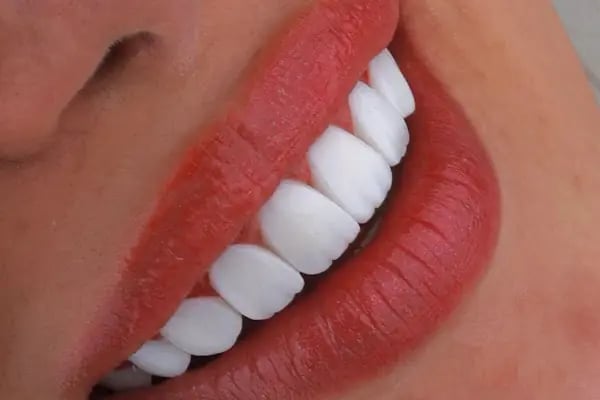 Estetik Bodrum | Dudak Dolgusu | Botoks | PRP | Mezoterapi | İp Askı | Cilt Bakımı | Gençlik Aşısı - Resim 9
