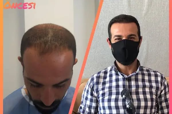 Mersin Rana Saç Ekim Merkezi - Resim 2