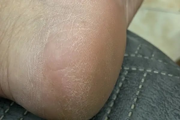 Nazlı Ekici Ayak Sağlığı Merkezi - Bodrum - Resim 12