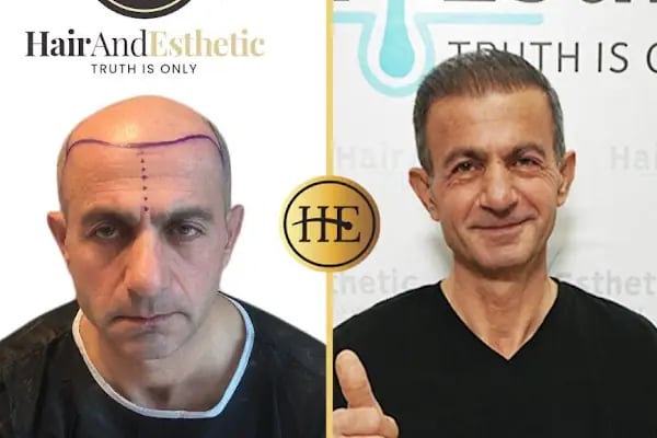 Hair and Esthetic - Resim 18