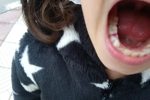 D&amp;T dental özel ağız ve diş sağlığı polikliniği - Resim 5