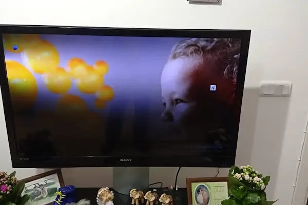 Alanya Tv Hastanesi - Resim 4