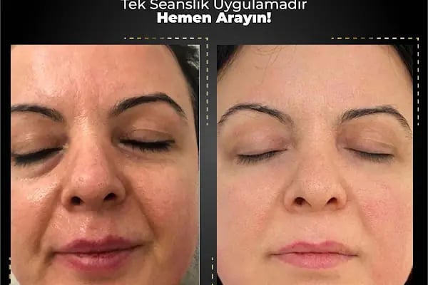 Hanife Bayan Kuaförü ve Güzellik Salonu - Resim 10