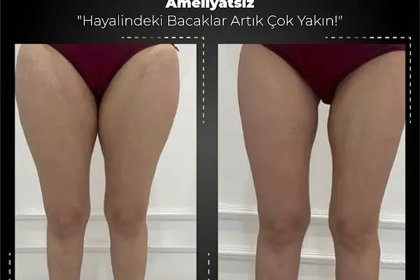 Hanife Bayan Kuaförü ve Güzellik Salonu - Resim 5