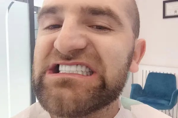 Turadent Ağız ve Diş Sağlığı Merkezi - Resim 17