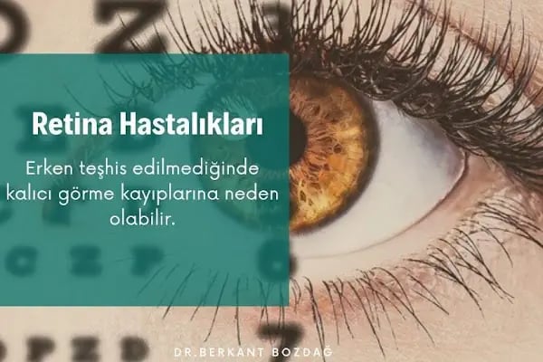 Op. Dr. Berkant Bozdağ | Katarakt Ameliyatı | Akıllı Lens | No Touch Lazer | Göz Kapağı Estetiği İstanbul - Resim 10