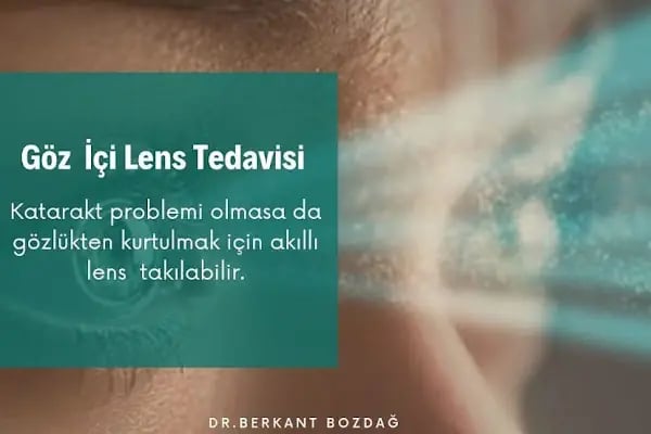 Op. Dr. Berkant Bozdağ | Katarakt Ameliyatı | Akıllı Lens | No Touch Lazer | Göz Kapağı Estetiği İstanbul - Resim 12