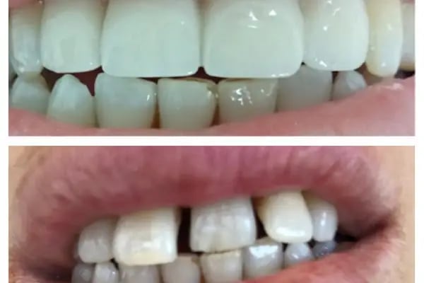 Bursa Elit Ağız ve Diş Sağlığı Polikliniği - Resim 13