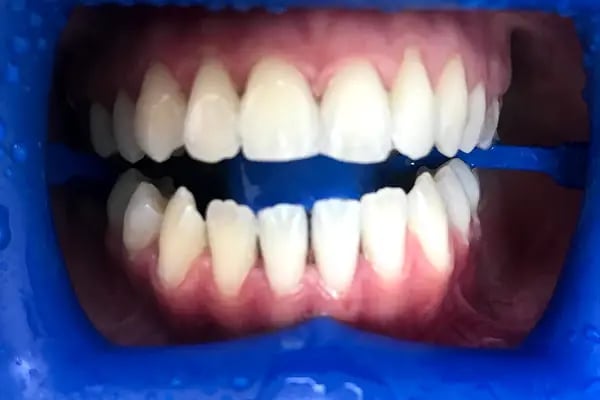 Bursa Elit Ağız ve Diş Sağlığı Polikliniği - Resim 14