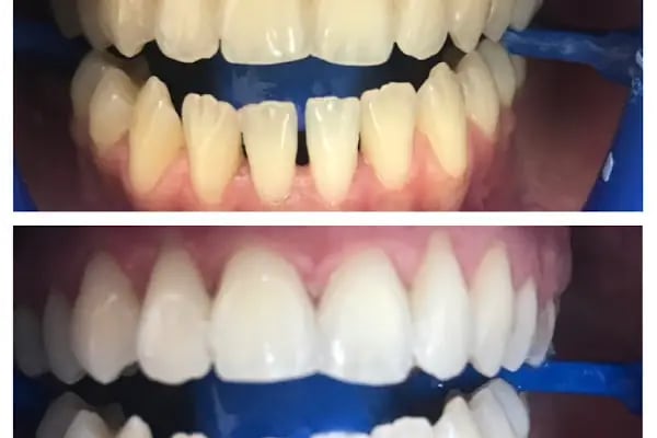 Bursa Elit Ağız ve Diş Sağlığı Polikliniği - Resim 12