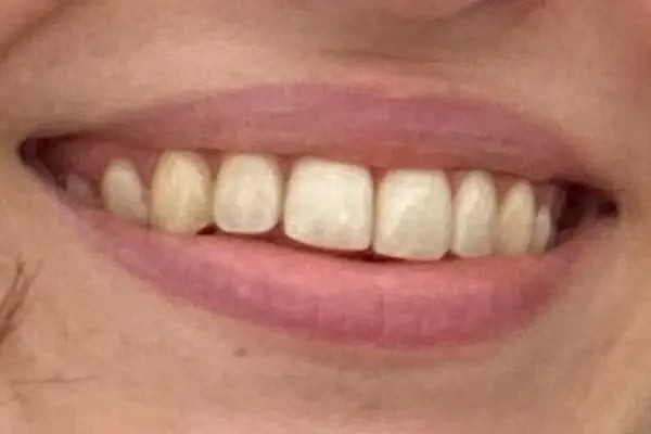 DentaCenter Keçiören - Resim 8