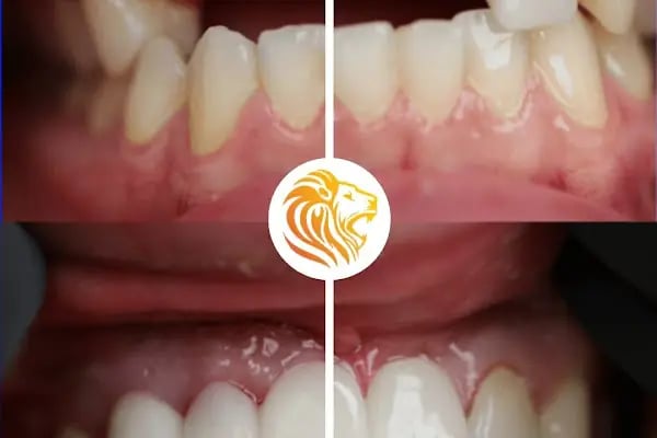 Op. Dr. Ali Dursun KAN PLASTİK ESTETİK VE REKONSTRİKTİF CERRAHİ&amp;GENEL CERRAHİ&amp;SAÇ EKİMİ - Resim 2