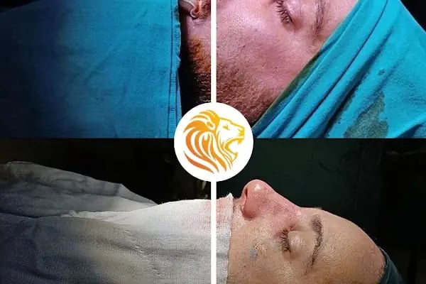 Op. Dr. Ali Dursun KAN PLASTİK ESTETİK VE REKONSTRİKTİF CERRAHİ&amp;GENEL CERRAHİ&amp;SAÇ EKİMİ - Resim 5