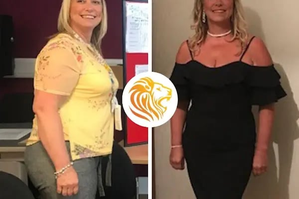 Op. Dr. Ali Dursun KAN PLASTİK ESTETİK VE REKONSTRİKTİF CERRAHİ&amp;GENEL CERRAHİ&amp;SAÇ EKİMİ - Resim 3