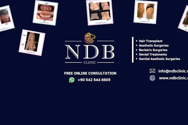 Op. Dr. Ali Dursun KAN PLASTİK ESTETİK VE REKONSTRİKTİF CERRAHİ&amp;GENEL CERRAHİ&amp;SAÇ EKİMİ - Resim 4