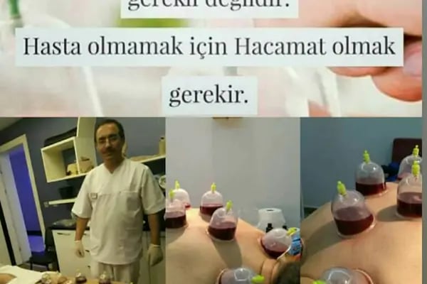 HACAMAT BEYPAZARI - Resim 18