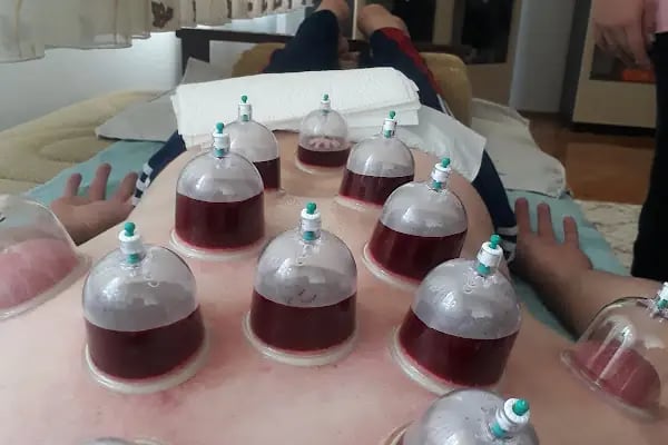 HACAMAT BEYPAZARI - Resim 14