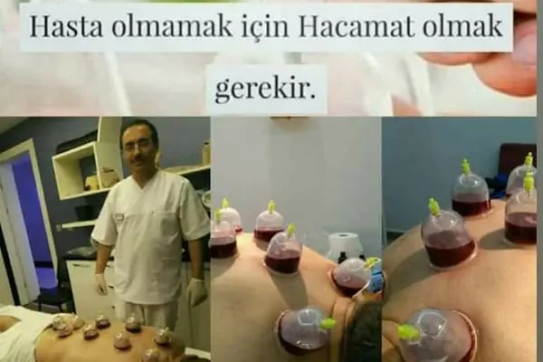 HACAMAT BEYPAZARI - Resim 20