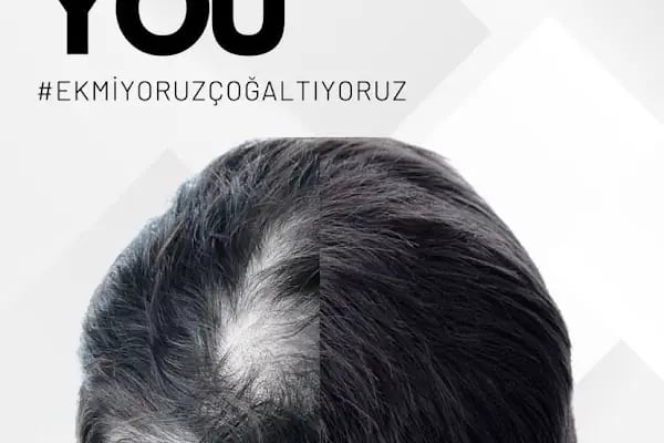 S Clinic Samsun - Saç Çoğaltma, Saç Bakım ve Güzellik Merkezi - Resim 19