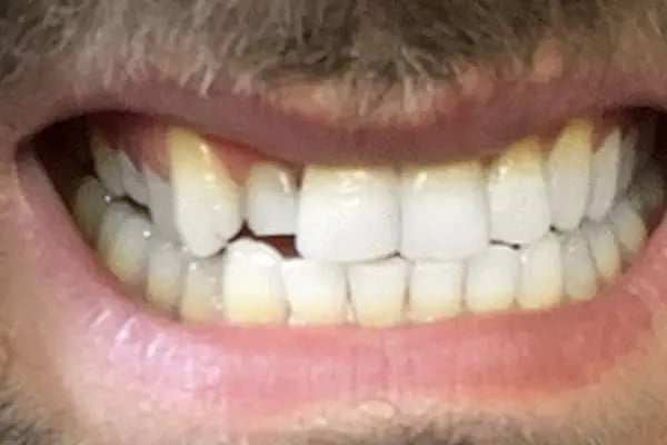 Özel Familya Diş Ağız ve Diş Sağlığı Polikliniği - Resim 16
