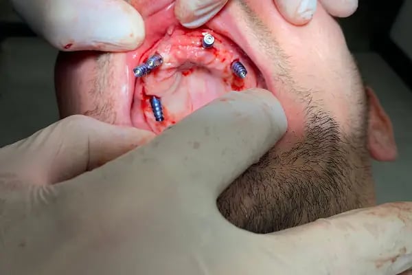 Özel Familya Diş Ağız ve Diş Sağlığı Polikliniği - Resim 17