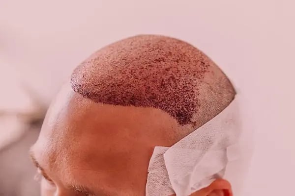 Febris Hair - Resim 1